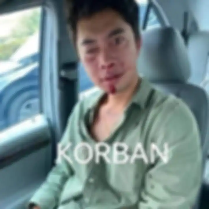 Anak Ali Fanser Ketum Pemuda Pejuang Bravo 5 jadi tersangka. Ternyata hidung anak anggota DPR berdarah bukan karena dibogem Ali Fanser.