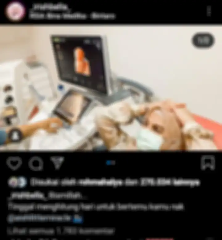 Irish Bella ramai kadi omongan dan kembali ke rumah sakit 