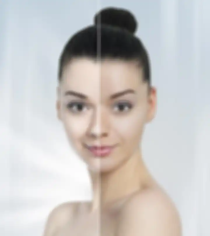 memutihkan wajah dengan bleaching, amankah?
