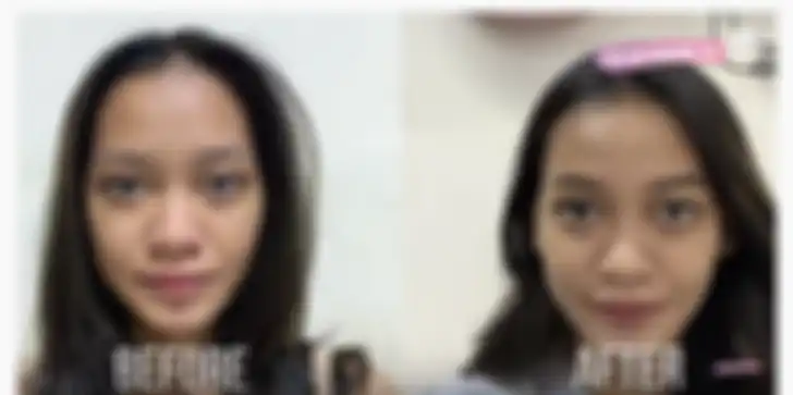 Hasil pemakaian face wash, toner dan moisturizing cream dari seri Emina Bright Stuff selama 1 minggu