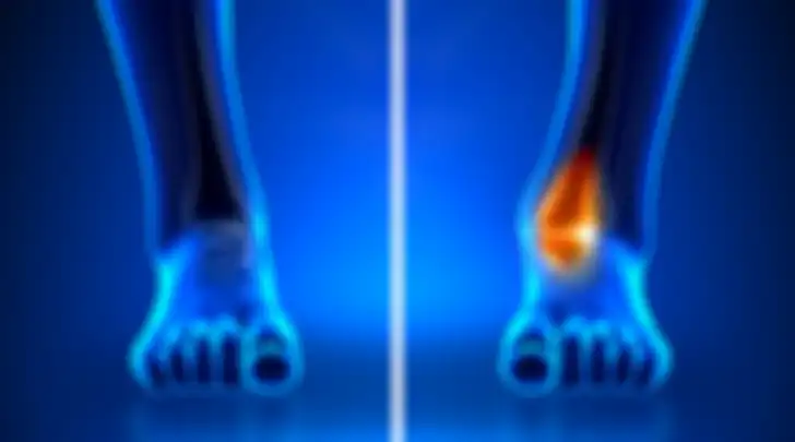 Deformitas kaki