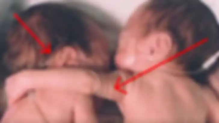 Bayi Brielle bisa bertahan karena si perawat bijak segera menyodorkan kembarannya agar terjadi kontak kulit ke kulit (skin to skin contact).