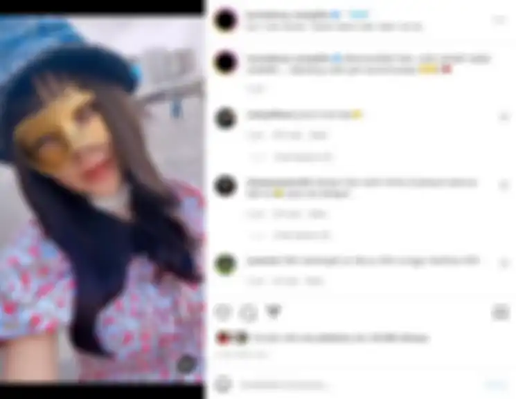 Lucinta Luna buka perban hasil operasi.