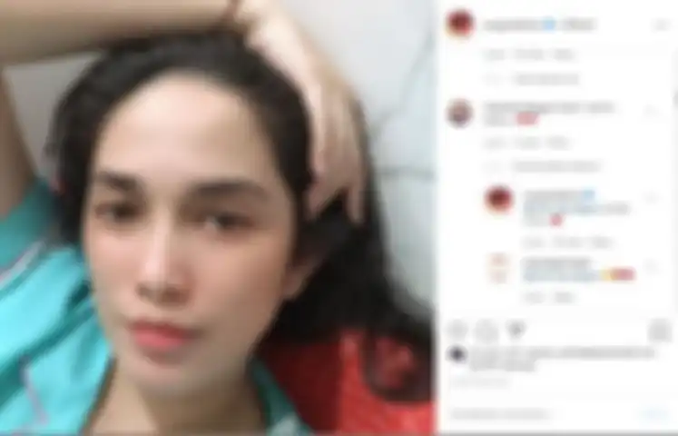 Ussy keluhkan pipinya tak lagi tirus