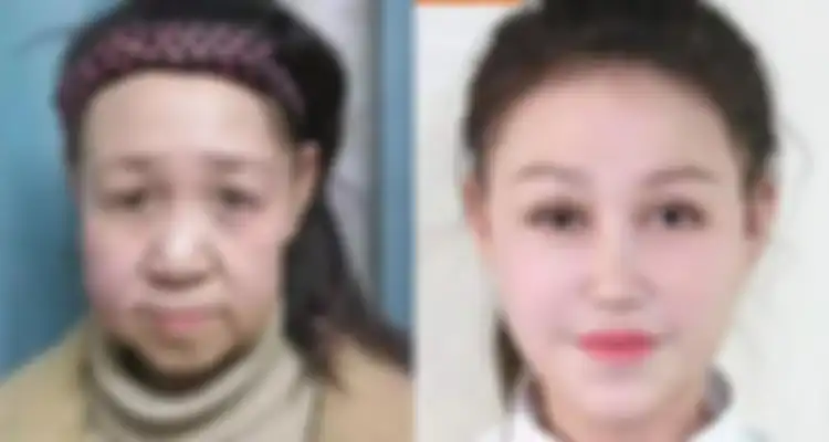 Kolase transformasi wajah Xiao Feng