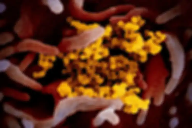 Gambar mikroskop elektron pemindai ini menunjukkan virus corona Wuhan atau Covid-19 (kuning) di antara sel manusia (merah).