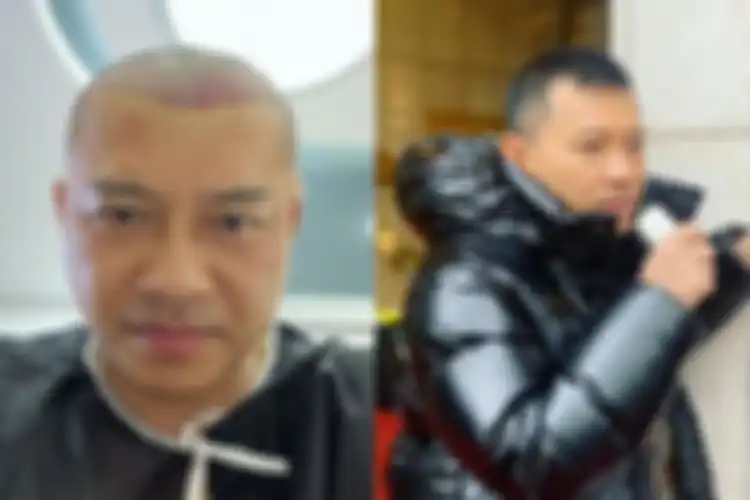 Anang Hermansyah cukur rambut sampai botak. 