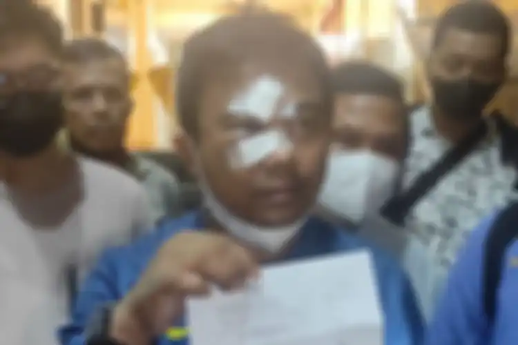 Haris Pertama babak belur dihajar debt collector