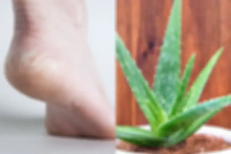 Jutaan Orang Enggak Tahu, Kaki Pecah-Pecah Bisa Dihilangkan Cuma Pakai Lidah Buaya, Ini Caranya
