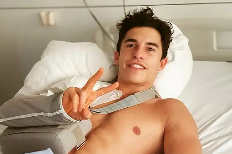 Update Kondisi Pembalap MotoGP Marc Marquez, Dokter Beri Kabar Gembira