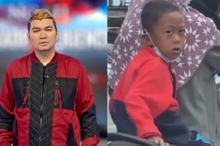 Indra Bekti Alami Pendarahan Otak, Pernah Dikerjain Bocah Dibonceng Motor Emak-emak