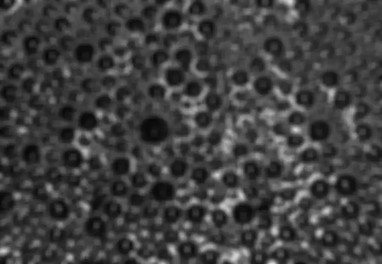 Trypophobia, Fobia Ketika Melihat Lubang