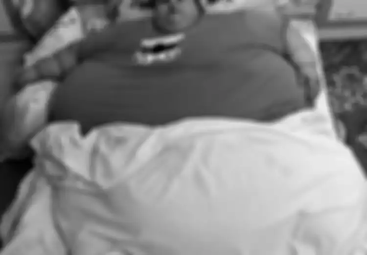 Meski Sukses Turunkan Berat Badannya hingga 100 Kg, Eman Ahmed Masih Perempuan Terberat di Dunia