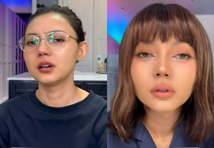 Rina Nose Blak-blakan Operasi Hidung dan Mata Sekaligus, Ternyata Ini Alasan Sebenarnya!
