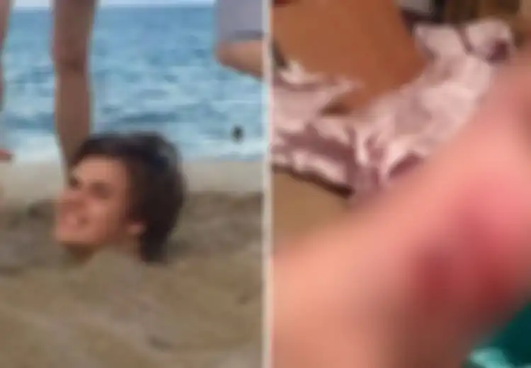 Kaki Anaknya Digigit Cacing Parasit, Ibu Ini Peringatkan Kita Semua Untuk Pakai Sandal di Pantai