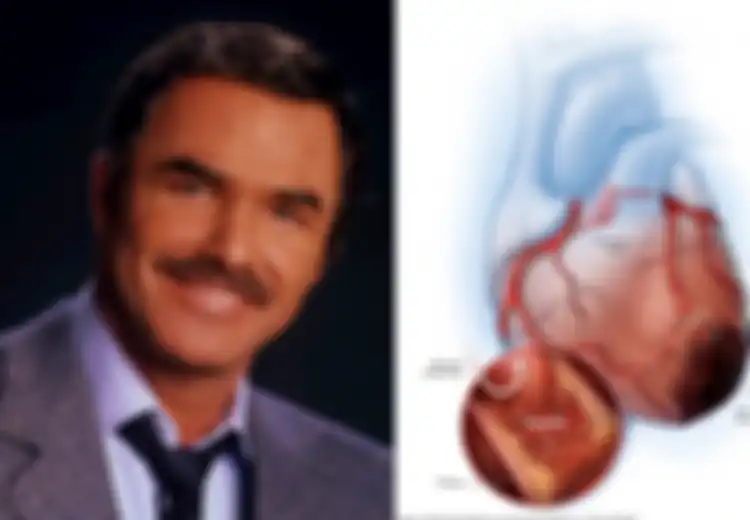 Bintang Hollywood Burt Reynolds Meninggal karena Serangan Jantung: 5 Olahraga Ini Bisa Cegahnya