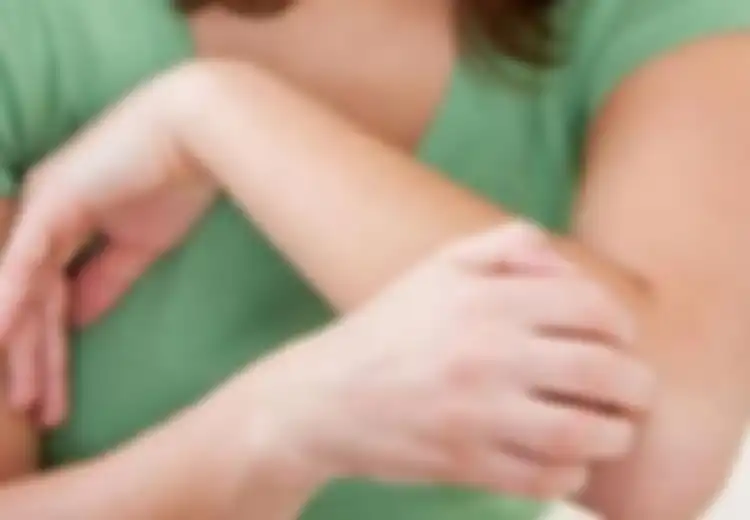 Alami Biduran Tapi Tak Tahu Penyebabnya? Ini Obat Biduran yang Cocok