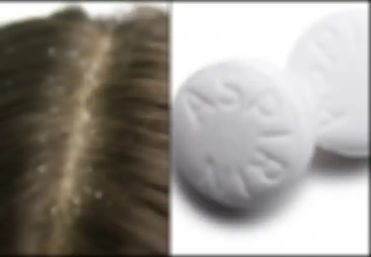 Sebelum Keramas, Coba Deh Gunakan Campuran Aspirin dan Cuka untuk Masker Rambut, Masalah Ketombe Akan Segera Tuntas!