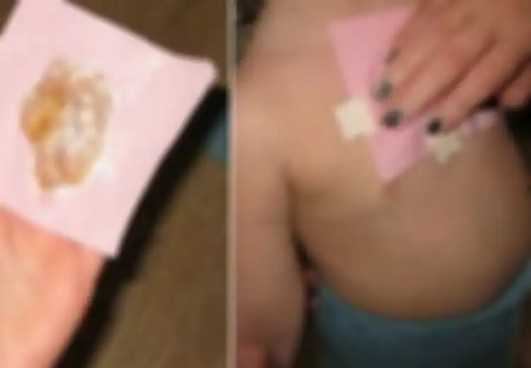Modal Bahan Rumahan, Ini Resep Obat Batuk Anak Tanpa Bahan Kimia