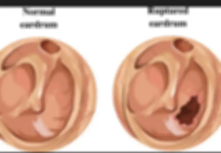 WHO Tegaskan Headphone Benar-benar Bisa Rusak Telinga, Kecuali Kita Lakukan 5 Hal Ini