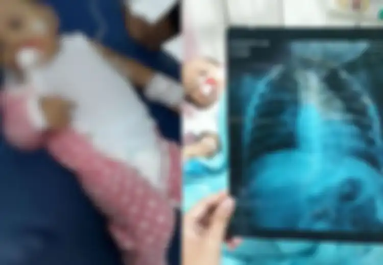 Sedih, Bayi Ini Meninggal Setelah Sering Hirup Asap Rokok dari Ayah dan Kakaknya