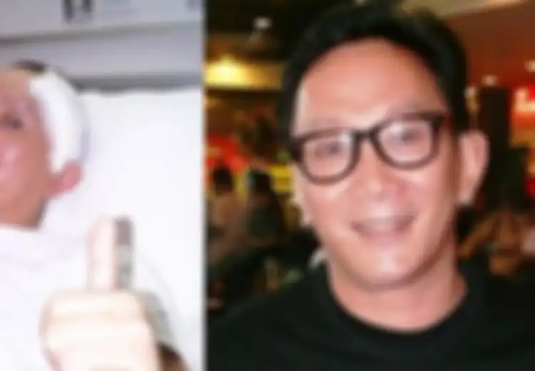 Robby Tumewu Meninggal dan Pernah Kena Stroke, Ini 9 Kebiasaan Sepele Pemicu Stroke