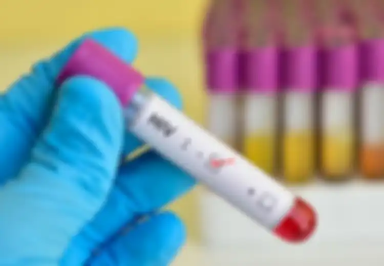 Jika Anda Memiliki HIV Ini 10 Cara Agar Tetap Sehat, Termasuk Jaga Kesehatan Mulut
