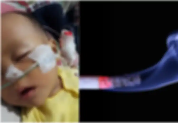 Kisah Seorang Bayi yang Derita Penyakit Ini Gegara Ayahnya Perokok, Begini Cara Efektif Agar Bisa Berhenti Merokok