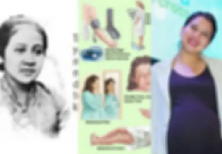 Tya Ariestya Terdeteksi Preeklampsia, Mengenal Penyakit yang Sebabkan RA Kartini Meninggal