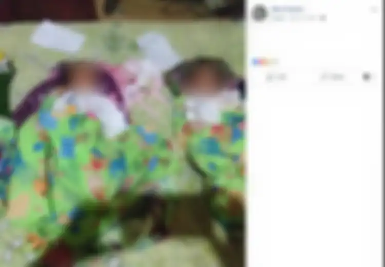 Ibu Asal Sulawesi Tengah Meninggal Saat Melahirkan Bayi Kembar 3: Ini Risiko Hamil dan Melahirkan Bayi Kembar