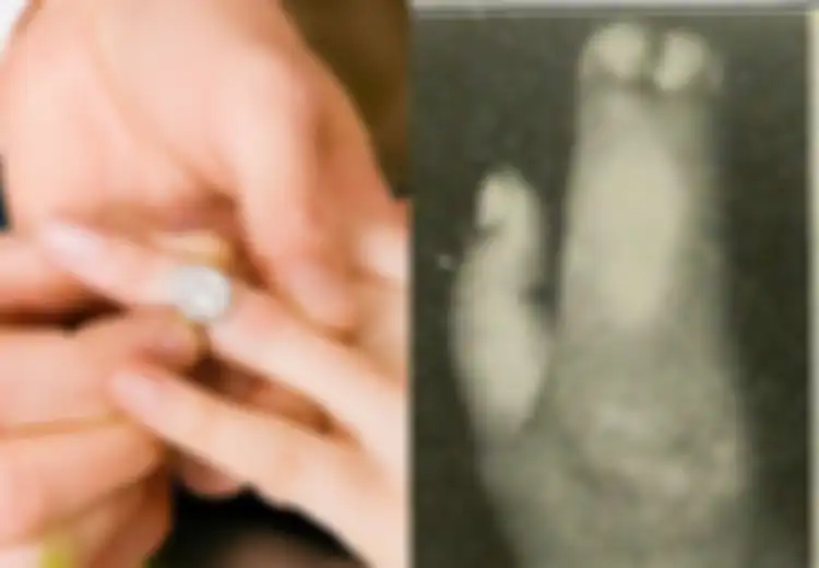 Viral Kakak-Adik Kandung Asal Bulukumba Menikah, Ini Mutasi Genetik yang Bisa Membuat Anak Hasil Inses Menjadi Cacat