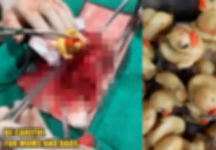 Doyan 'Memangsa' Bebek Karet Mainan, Perut Seekor Anjing Harus Dibedah, Setelah Dikeluarkan Jumlahnya Fantastis