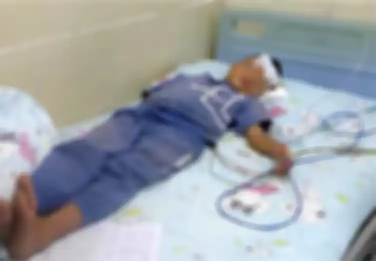 Akibat Minum Air Mentah, Bocah Ini Batuk Darah Selama 10 Hari, Rupanya Ini yang Ada dalam Tenggorokannya