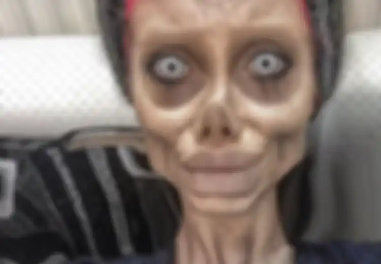 Lakukan 50 Kali Operasi Plastik demi Mirip Angelina Jolie, Wajah Gadis Ini Justru Mengerikan, Nasibnya Kini Pun Tak Kalah Memprihatinkan