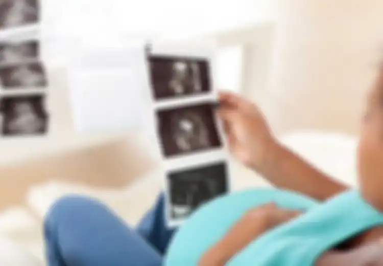 Mengenal Mirror Syndrome yang Sebabkan Irish Bella Kehilangan Calon Anak Kembarnya