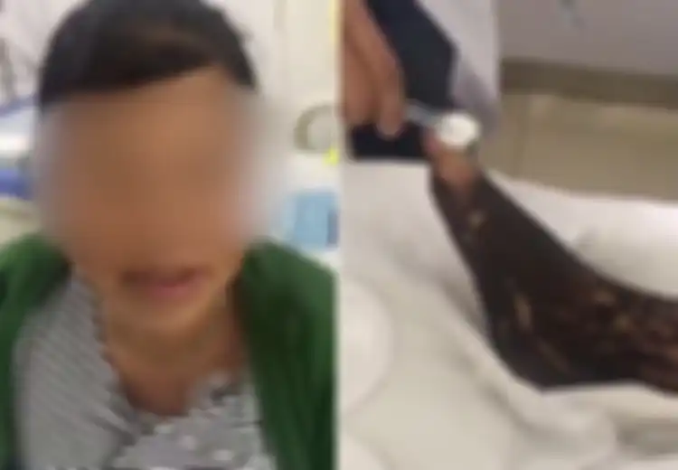 Tiru Adegan di TV, Wanita Ini Lakukan Hal Konyol Sekaligus Sia-sia saat Dirinya Digigit Ular, Ini Cara Benar Menolong Korban Gigitan Ular