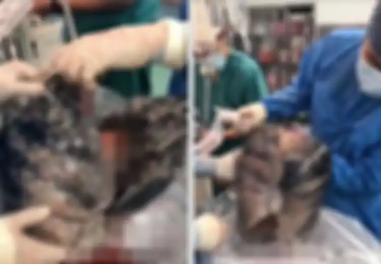 Terima Sumbangan Paru-Paru dari Seorang Perokok Berat, Seorang Dokter Syok Bukan Main Menyaksikan Kondisinya Menghitam dan Bikin Mual, Sampai Ogah Menerimanya
