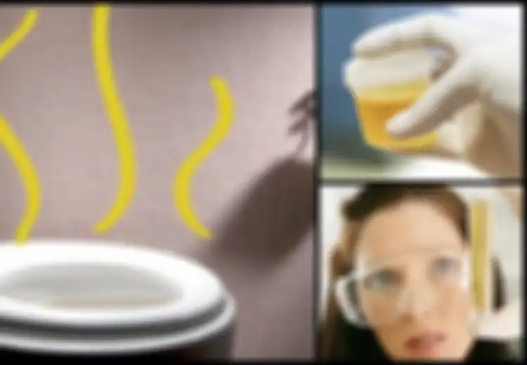 Waspada Jika Urin Berbau, Bisa Jadi 9 Hal Inilah Penyebabnya, Termasuk Adanya Infeksi Menular Seksual!