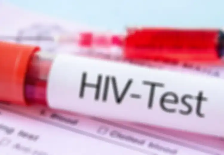 Kasus HIV/AIDS di Bandung Capai 12.358 Kasus: Sudah Meninggal, Pria Ini Baru Ketahuan Punya 40 Pacar Sampai Beri 'Warisan' Mengerikan Ini
