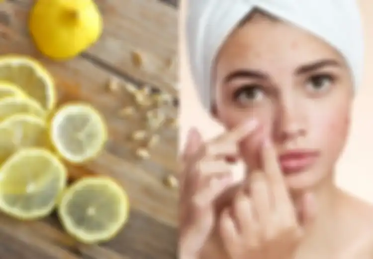 Tidak Hanya Air dan Kulitnya, Ini 10 Manfaat Ajaib dari Biji Lemon untuk Kesehatan, Salah Satunya Obati Jerawat