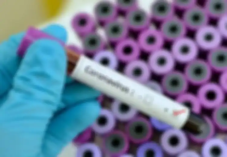 Ilmuwan Ungkap Meskipun Bisa Sembuh dari Virus Corona Ternyata Fungsi Paru-Paru Orang yang Pernah Menderita Virus Corona Akan Berkurang Hingga 30 Persen, Inilah Dampak yang Dirasakannya