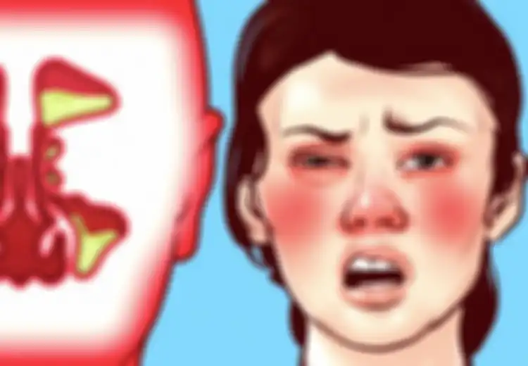 Mengatasi Hidung Mampet dalam Waktu 15 Menit, Cukup dengan Pijat Bagian Ini!