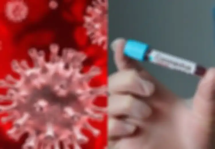 Dipanaskan Pada Suhu 60 Derajat Virus Corona Ternyata Masih Bisa Hidup, Ilmuwan Ungkap Satu-satunya Cara Membunuh Virus Corona 
