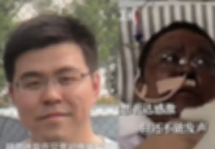 Penyebab Kematian Dokter Wuhan yang Kulitnya Menghitam Saat Jalani Perawatan Covid-19 Tak Diketahui, Publik China Marah