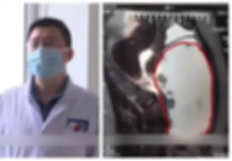 Orang Tua Panik Mengetahui Anak Gadisnya yang Baru Berusia 15 Tahun Hamil Perutnya Terus Membesar, Setelah Periksa ke Dokter, Orang Tua Makin Syok
