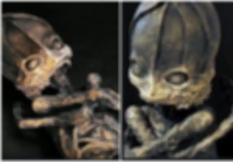Makhluk Aneh Dipercaya Alien, Tak Disangka Ini Adalah Bayi Manusia, 23 Tahun Terungkap Penyebab Mengapa Wujudnya Sangat Mengerikan
