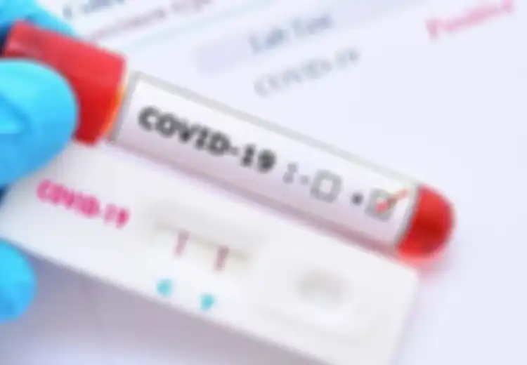 Dokter Spesialis Paru Berikan Opsi Deteksi Kilat Covid-19 Lewat Tes Swab Antigen, Dijamin Lebih Akurat Dibanding Rapid Test