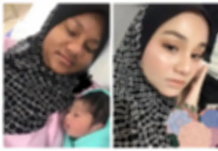Padahal Sebelumnya Putih Bersih, Wajah Wanita Ini Berubah Menjadi Gelap Saat Hamil hingga Membuatnya Terpukul, Rupanya Inilah yang Terjadi
