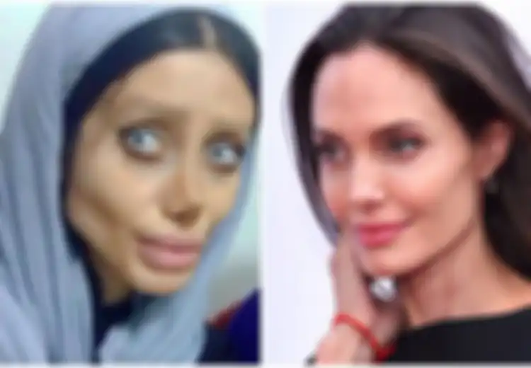 Dulu Sangat Viral Wajahnya Hancur Total Gara-gara Oplas Supaya Mirip Angelina Jolie, Wanita Ini Kini Nasibnya Sungguh Mengenaskan, Meringkuk di Penjara Sambil Menderita Covid-19