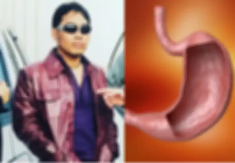 Erwin Prasetya Meninggal Karena Pendarahan Lambung, Ternyata Konsumsi Jenis Makanan Sejuta Umat Ini Bisa Merusak Lambung Kita Loh, Hati-hati!